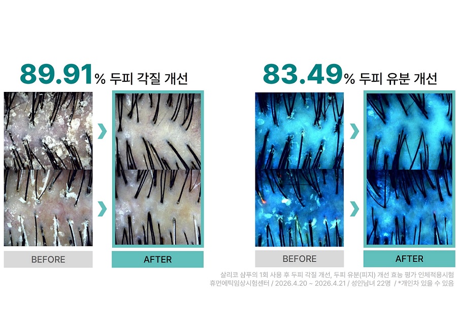더마리움 ‘살리코 샴푸’, 두피 진정·헤어 볼륨 개선 확인