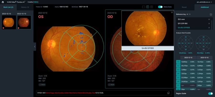 뷰노, 국제 의료AI 경진대회서 1위